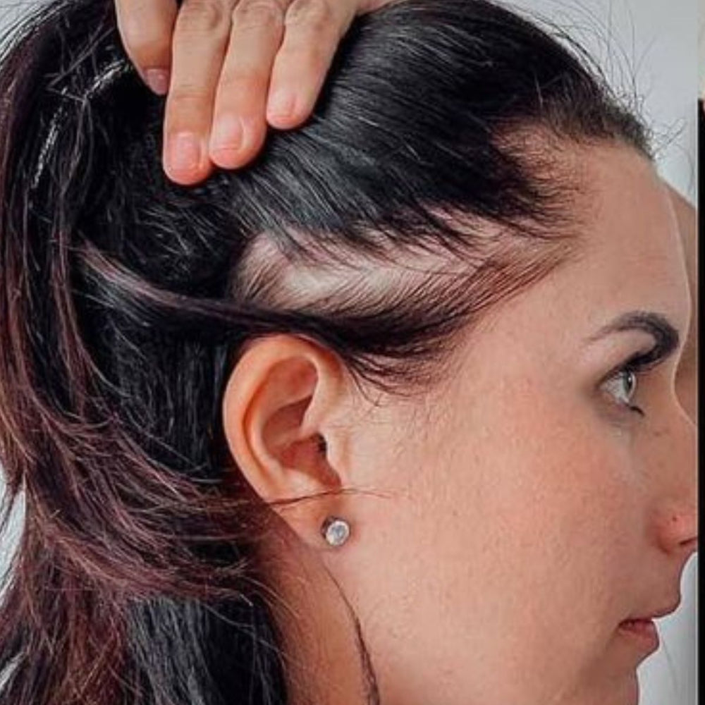 Antes